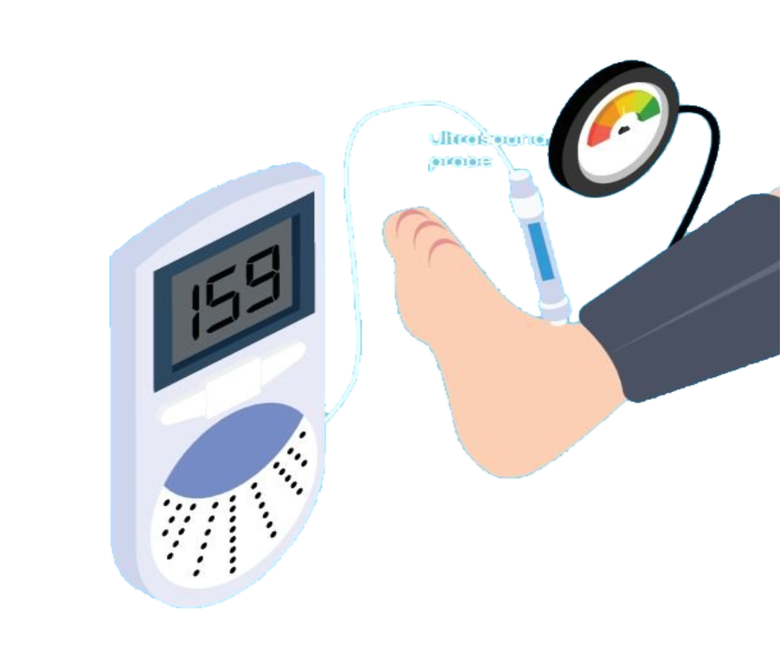 Vascular Doppler