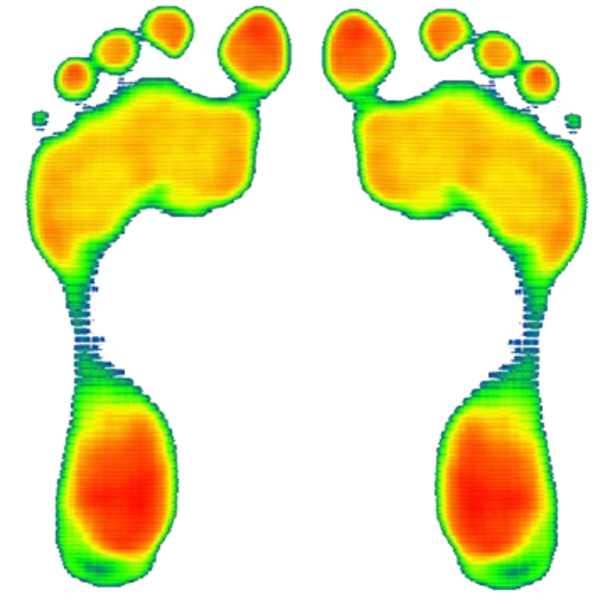 Foot Pressure Study