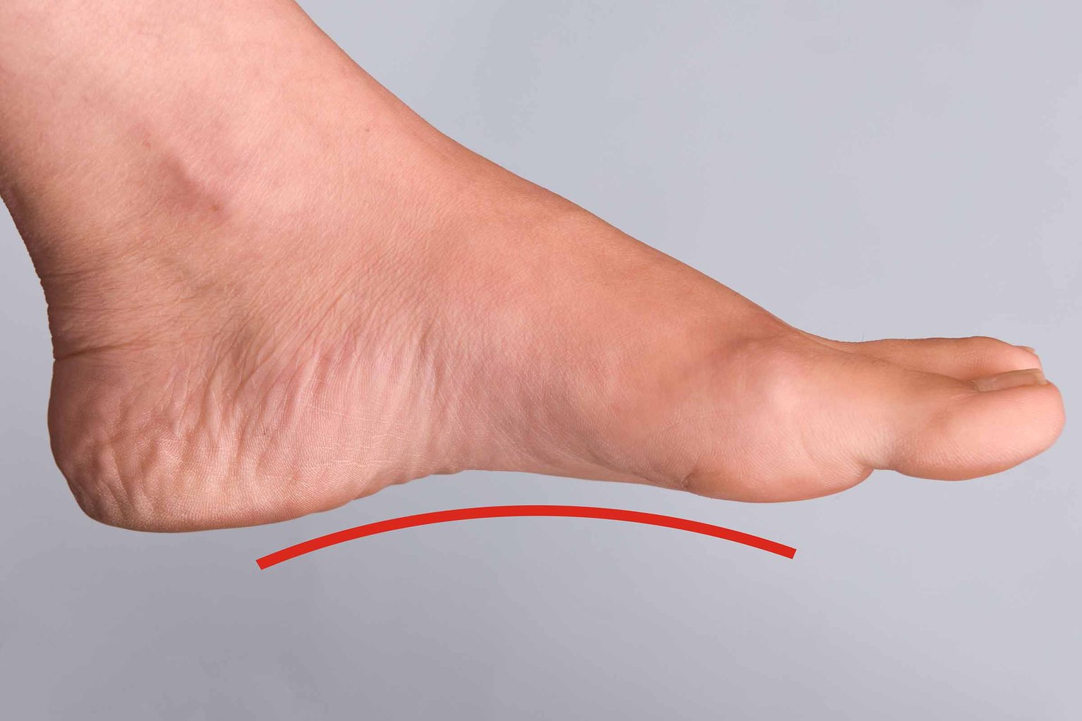 Arch Pain & Flat Foot